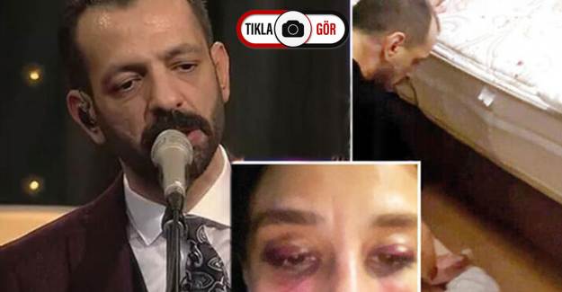 Özer Arkun’un 35 Yıla Kadar Hapisle Cezalandırılması Talep Edildi