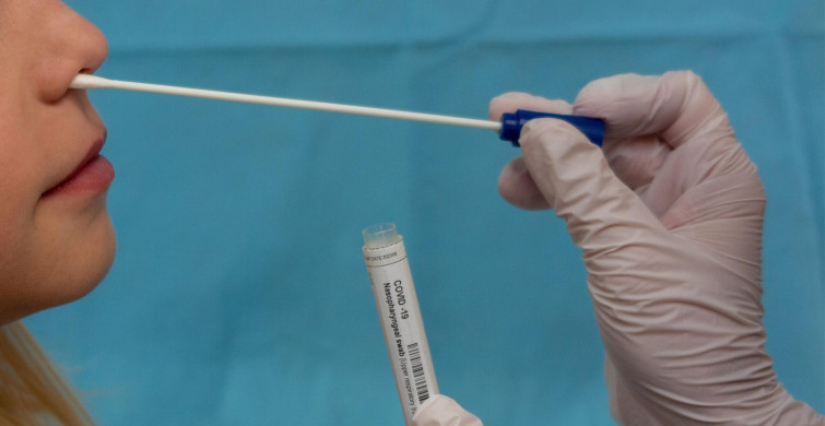 PCR Testi Nedir, Ücretli mi?