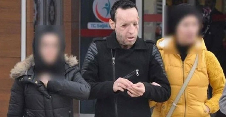 Recep Sert kimdir, tutuklandı mı? Yüz nakli yapılan Recep Sert hakkında bilgiler