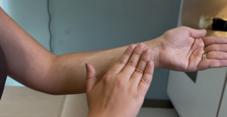 Sahte güneş kremlerine dikkat: 'Hastalar alerjik reaksiyonlarla çok başvuruyor'