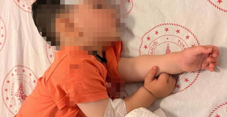 Şanlıurfa'da sokak köpekleri 1 buçuk yaşındaki çocuğu yaraladı