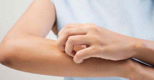 Sivrisineklere Elma Sirkesi ile Savaş Açın