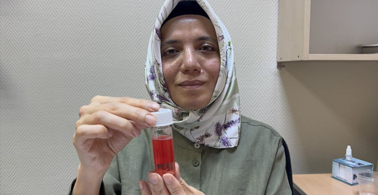 Süleyman Demirel Üniversitesi Göz Bankası'nın Başarılı Kornea Nakilleri