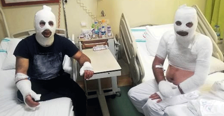 Tinerle Temizlik Yaparken Sigara Yakınca Yandı