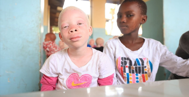 Türk Diyanet Vakfı'ndan Tanzanya'ya Albino Çocuklara Destek