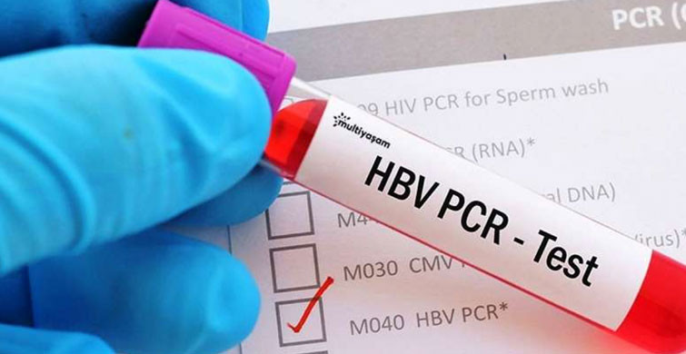Türkiye İle Sırbistan Arasında PCR Testi Zorunluluğu Kaldırıldı