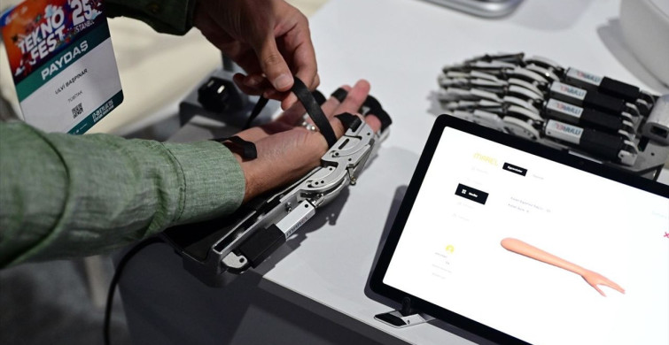 Yerli Robotik El Rehabilitasyon Sistemi Tanıtıldı
