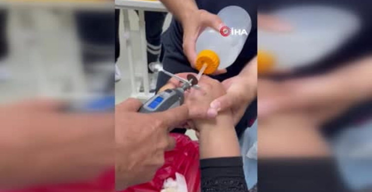 Yüzüğü parmağına sıkışan kadının yardımına itfaiye ekipleri koştu