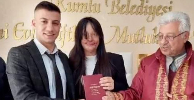 Yüzünü Asitle Yakan Sevgilisini Affeden Berfin Özek Ozan Çeltik'le Evlendi