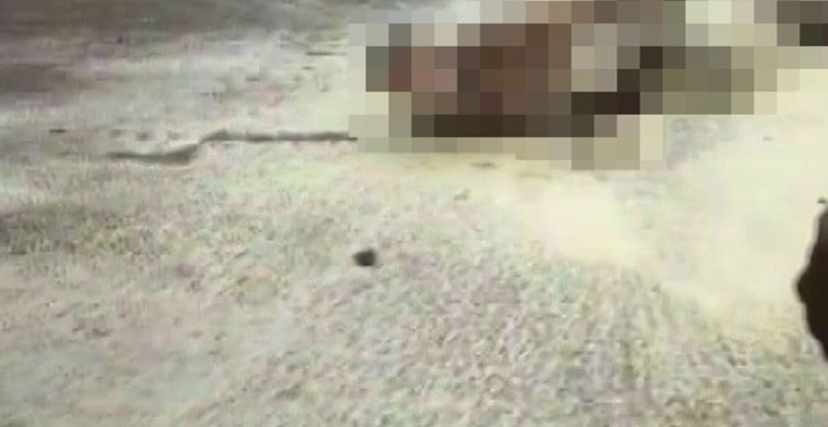 Zihinsel engelli şahıs, benzinle kendini yakarak 9 gün sonra yaşamını yitirdi