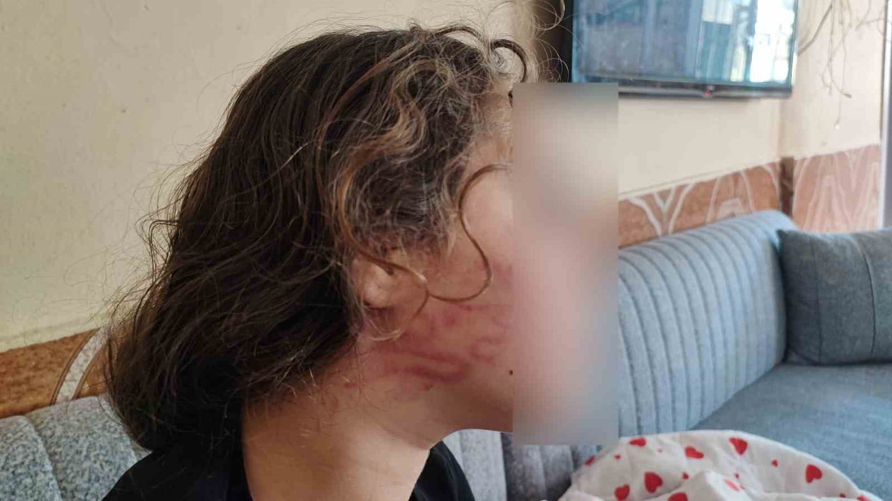 ADANA'DA KIZININ DARP EDİLDİĞİNİ ÖNE SÜREN BİR KADININ, KAVGA EDEN ÇOCUK YERİNE EPİLEPSİ HASTASI...