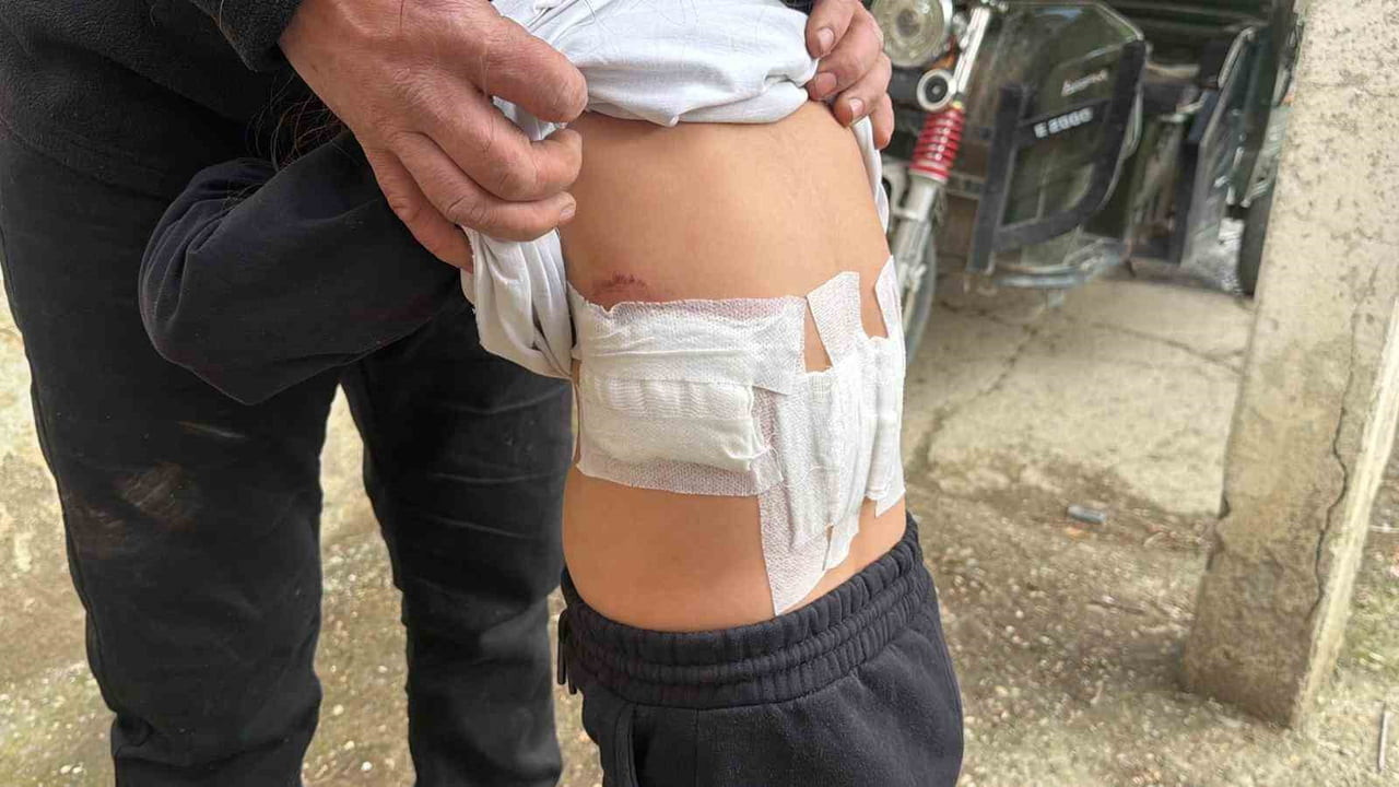 AFYONKARAHİSAR’DA EVİNİN BAHÇESİNDE OYNAYAN 5 YAŞINDAKİ KIZ ÇOCUĞU EŞEĞİN SALDIRISI SONRASI...