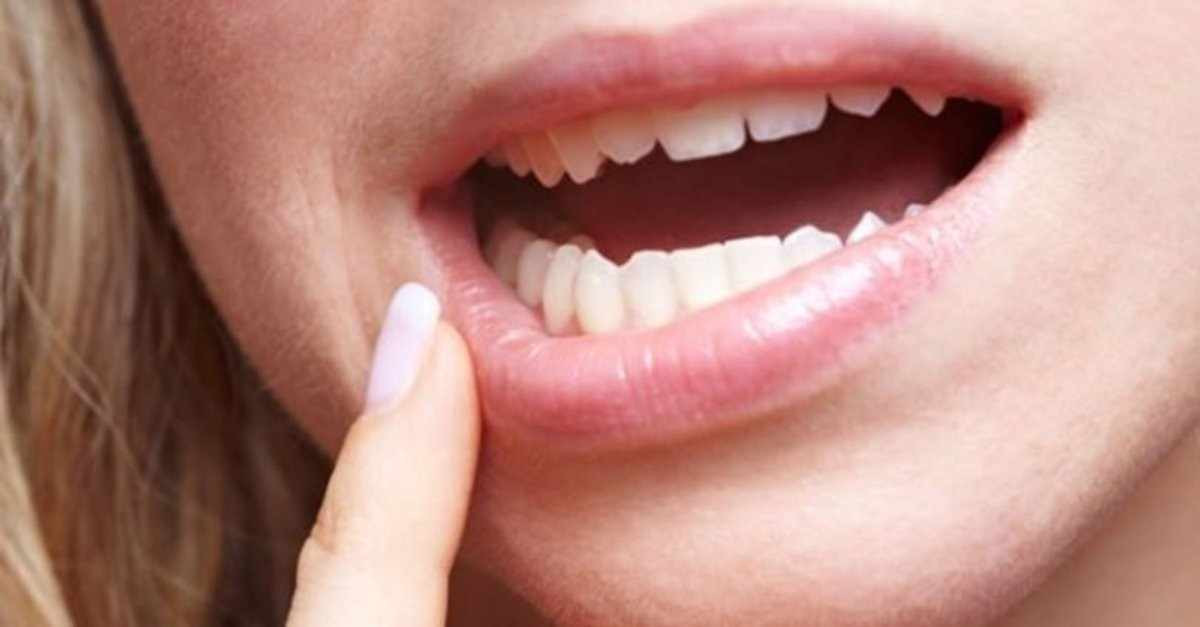 Ağız içi kaşıntı hangi hastalığın habercisi