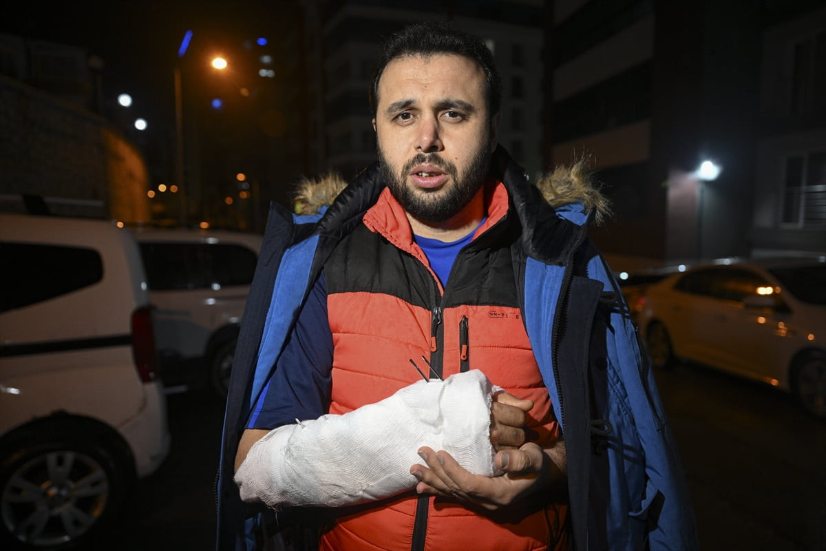 Ankara'nın Mamak ilçesinde sahipsiz köpeklerin saldırısından kaçarken düşerek kolu kırılan Yasin...