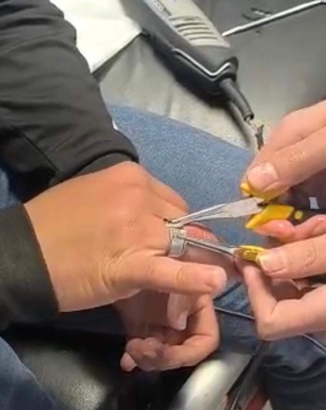 BATMAN’DA PARMAĞINA SIKIŞAN YÜZÜĞÜ KENDİ İMKÂNLARIYLA ÇIKARAMAYAN VATANDAŞ, İTFAİYE EKİPLERİNDEN...