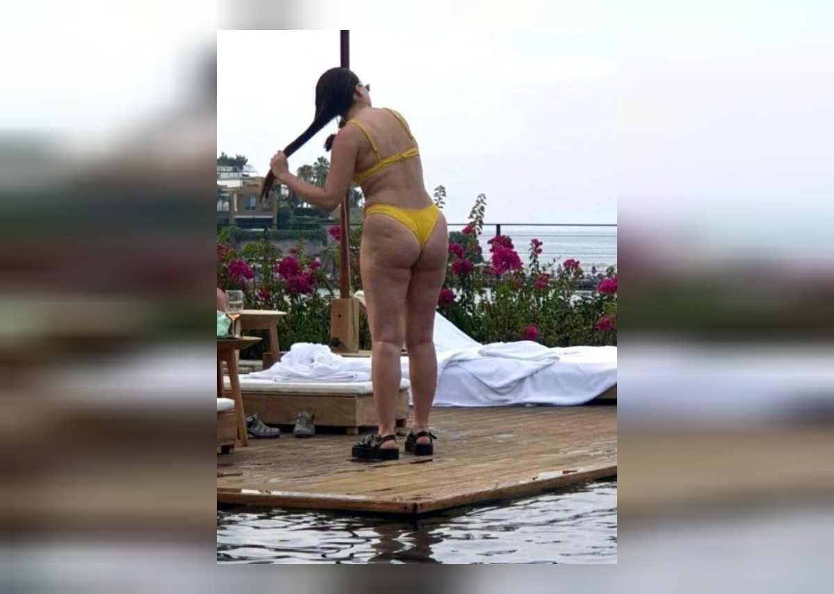 duygu özaslan selülitleri