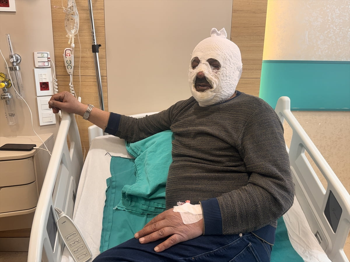 Erzincan’da kalorifer görevlisi arkadaşına yardım etmek isterken kalorifer kazanına benzin döktüğü...