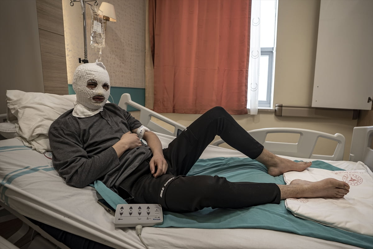 Erzurum'da çakmağına gaz doldurduğu tüpün patlaması sonucu yüzü ve göğsü yanan gencin hastanedeki...