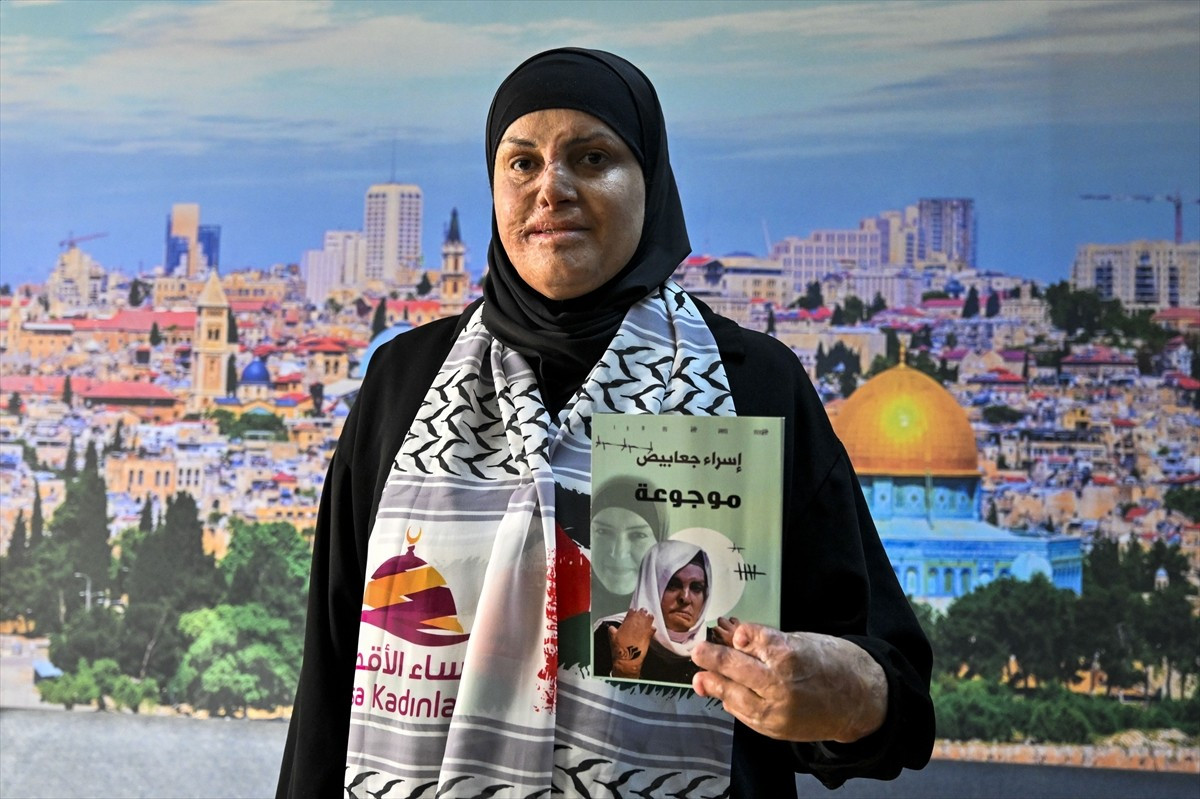 İsrail hapishanelerinde vücudundaki ağır yanıklarla 8 yıl geçiren Filistinli İsra Ceabis, 3....