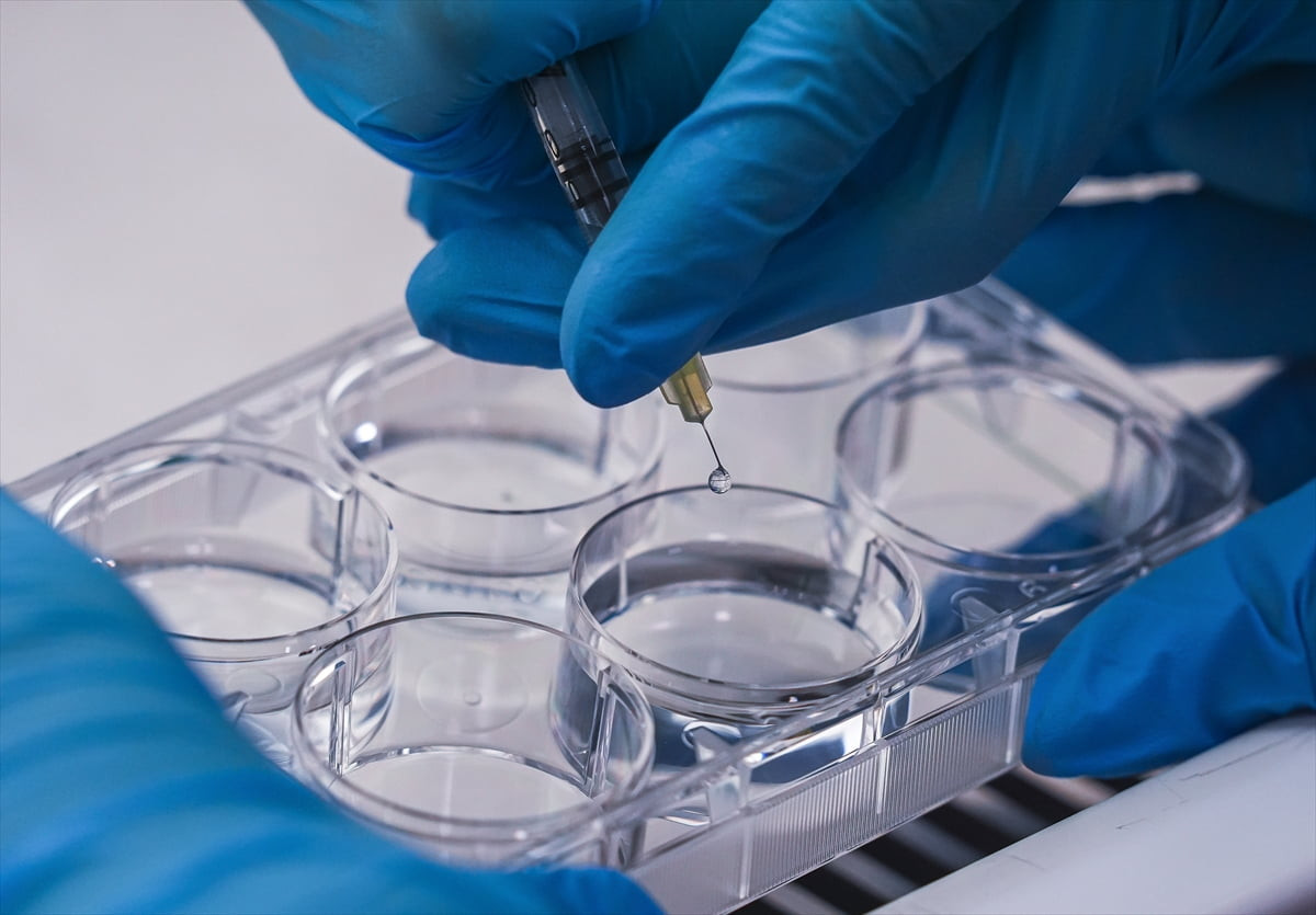 İzmir Yüksek Teknoloji Enstitüsü'nde (İYTE) geliştirilen probiyotik içeren yeni nesil "yara...