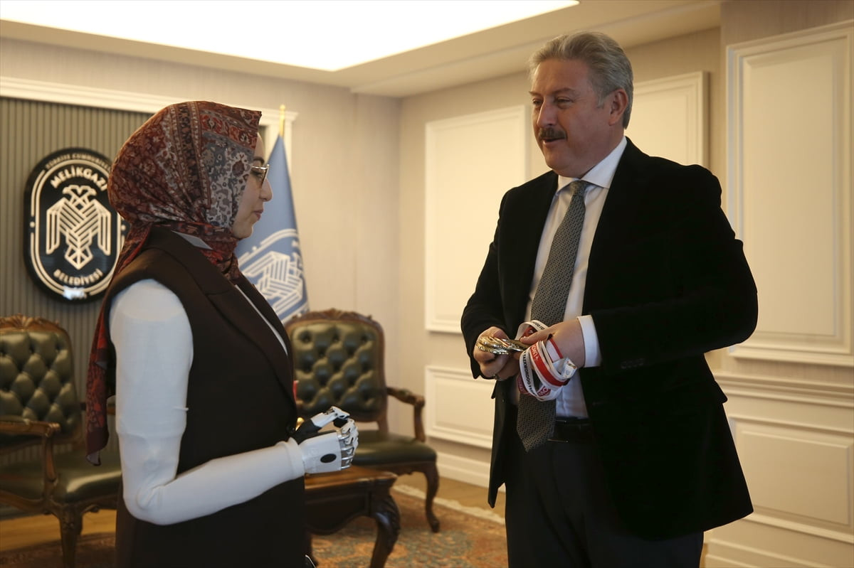 Kayseri'de 5 yıl önce hamur yoğurma makinesine kaptırdığı iki kolunu da kaybeden Sevim Nur Türkmen...