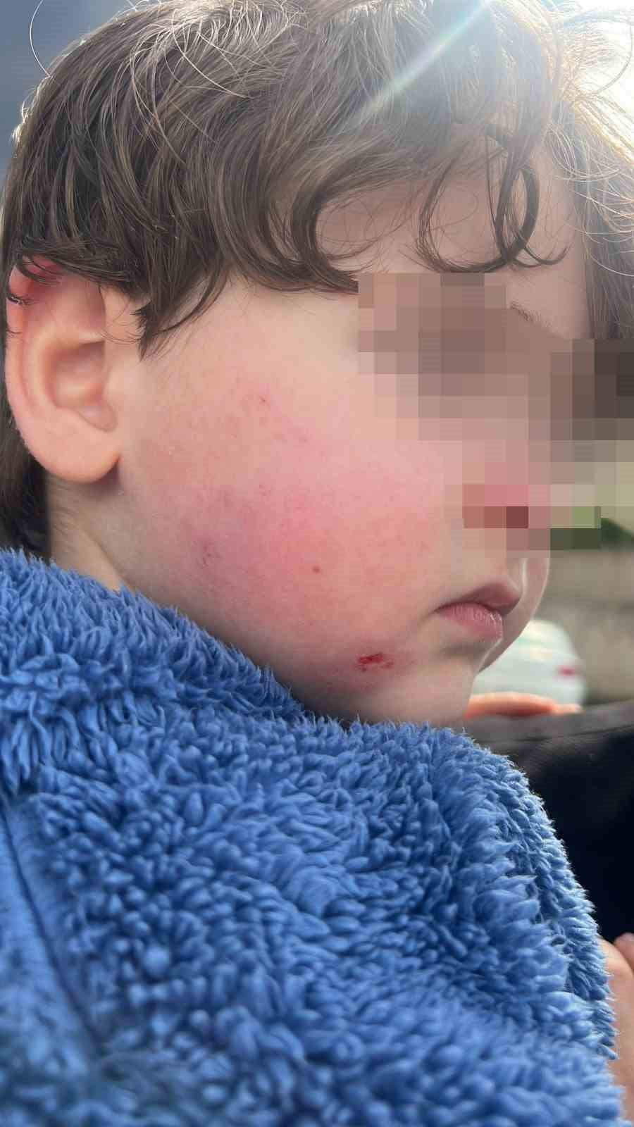 KREŞE BIRAKTIĞI ÇOCUĞUNU DARP EDİLMİŞ HALDE ALDI