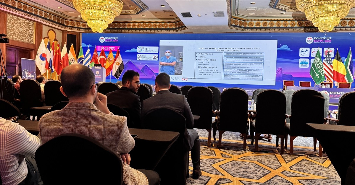 Mısır'ın başkenti Kahire'de, Mısırlı doktorların yanı sıra dünyada organ nakli alanında görev...