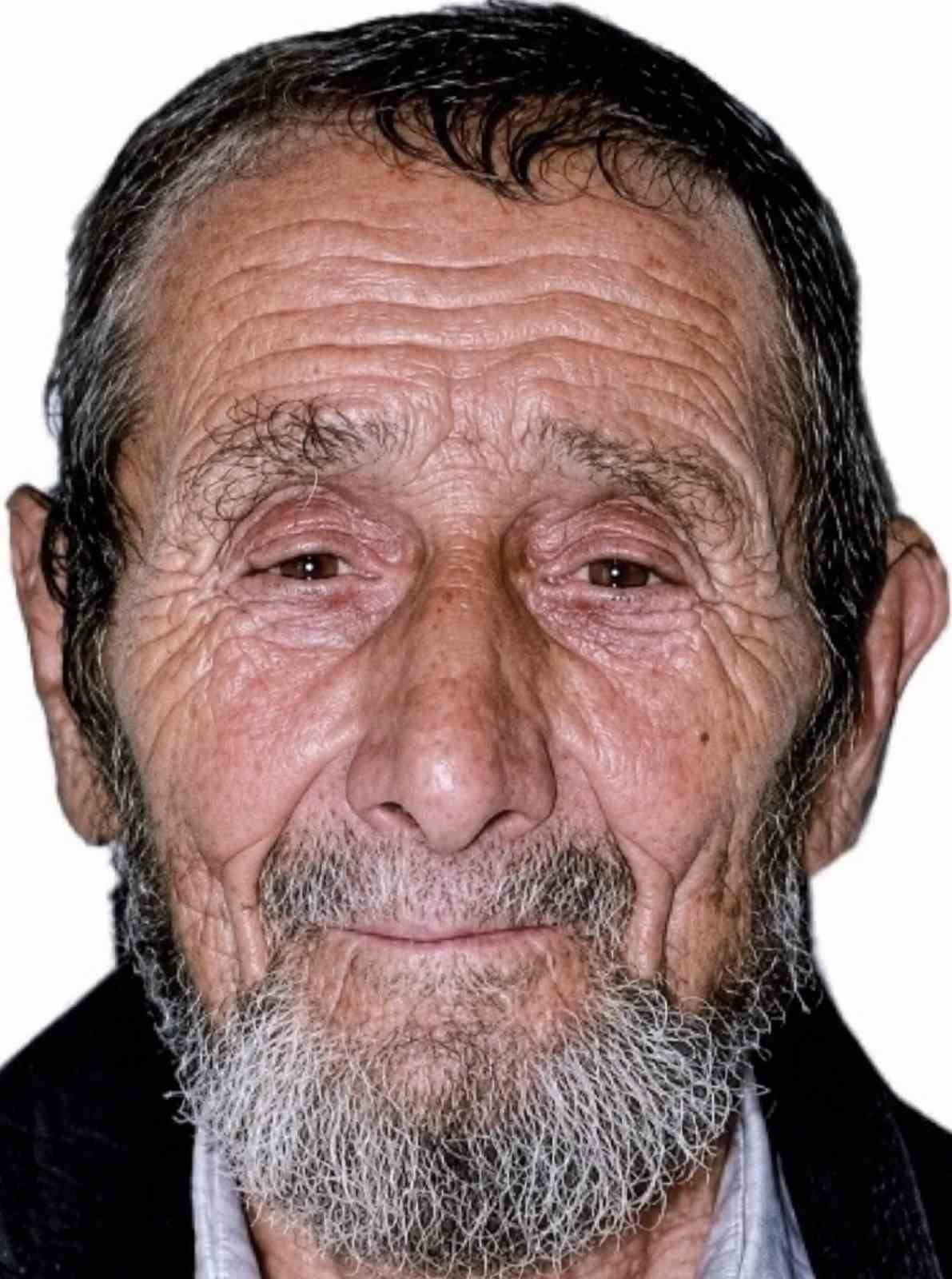 SAMSUN’DA BAHÇESİNDE KESTİĞİ AĞACIN ÜZERİNE DEVRİLMESİ SONUCU AĞIR YARALANAN RECEP SALİÇ (81)...