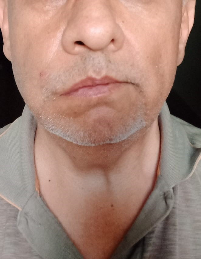 SARP EDİLEN DOKTOR