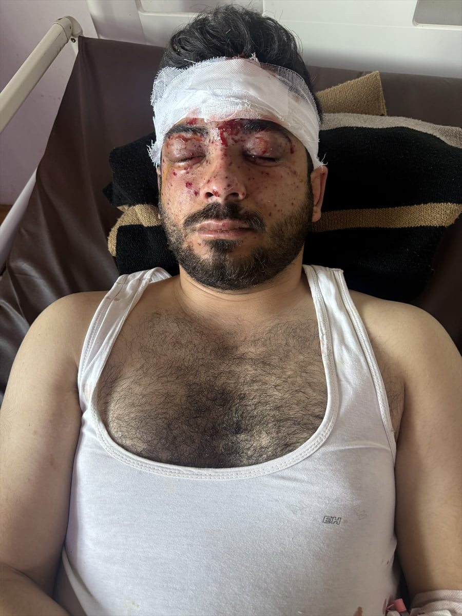 Suriye ordusunun mayın temizleme çalışmaları sırasında meydana gelen patlamada haber çalışması...