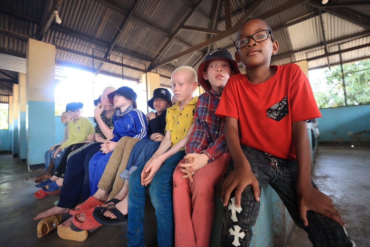 Türk Diyanet Vakfı (TDV), Tanzanya'da vücutlarındaki bir pigmentin eksikliği nedeniyle "beyaz"...