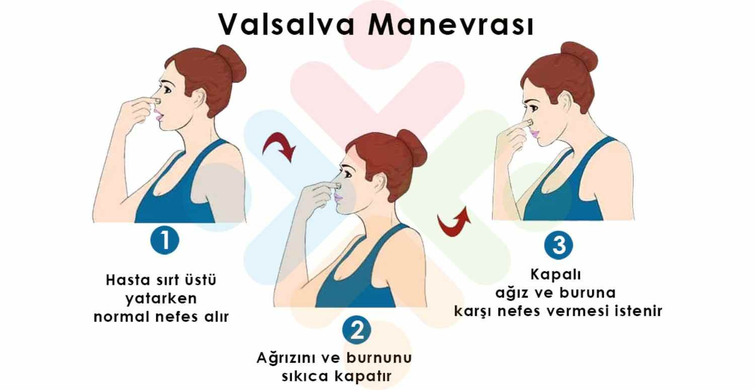 Valsalva manevrası