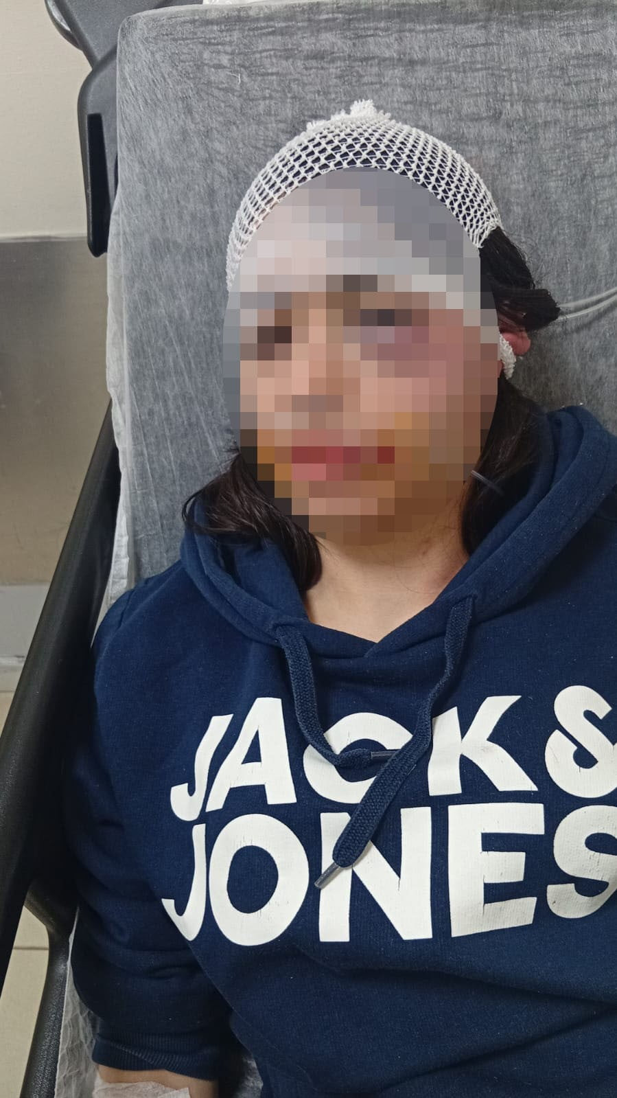 YEŞİM MUCİZE Ö. DARP EDİLMİŞTİ (ARŞİV)