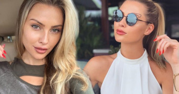 Chloe Louhgnan Estetik Sonrası Şiş Yüzü İle Görüntülendi