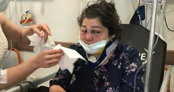 CHP’li Belediye Başkanına Skandal İddia; 'Park Bakımsız’ Diyen Kadını CHP’li Başkanın Korumaları Darp Etti