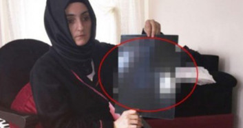 Genç Kadının Karnından Öyle Bir Şey Çıktı ki!