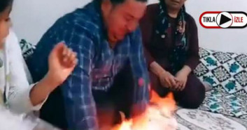 TikTok Uğruna Kocasının Ellerini Yaktı