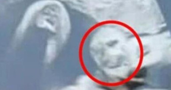 Hamile Kadın Ultrason Fotoğrafında Büyükbabasını Gördü