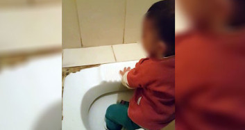 Küçük Çocuğun Ayağı Tuvalet Deliğine Sıkıştı