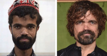 Pakistanlı Rozi Khan, Game of Thrones'taki Tyrion Lannister Karakterine Benzerliği ile Dikkat Çekiyor