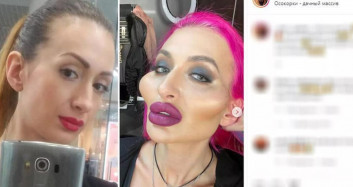 Ukraynalı modelden estetik terörü: Duru güzelliğini öyle bir hale getirdi ki! Artık korku filmlerinde oynayabilir...