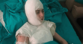 İstanbul'da Akıl Almaz Vicdansız Üvey Anne Şiddeti !