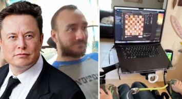 Elon Musk görüntüleri paylaştı: Felçli gencin beynine çip yerleştirildi sonrası tam bir mucize!