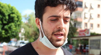 Köpeklerini Gezdiren Genç Sokak Ortasında Saldırıya Uğradı