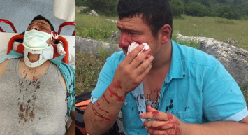 Kurduğu Kaçak Yapılarla Anılan Lütfü Türkkan’ın Adamlarından İHA Muhabirine Kanlı Saldırı Geldi