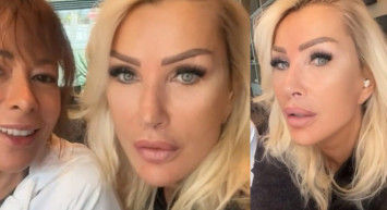 Seda Sayan gençleşmek uğruna öyle bir şey yaptı ki! Sünnet derisini...