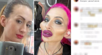 Ukraynalı modelden estetik terörü: Duru güzelliğini öyle bir hale getirdi ki! Artık korku filmlerinde oynayabilir...