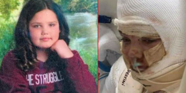 TikTok Akımı için Canından Oluyordu