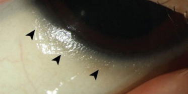 Uzmanlardan Flaş A Vitamini Uyarısı!