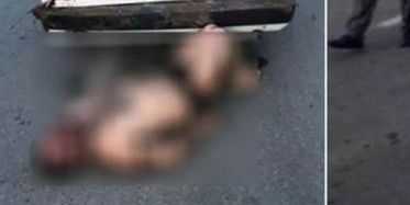 Rize'de Darbedilen Kişi Bagajdan Çıkarılırken Yakalandı!